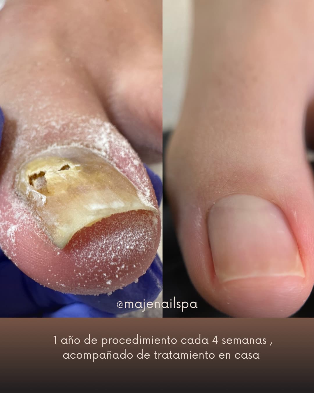 Mantenimiento de Quirópedia